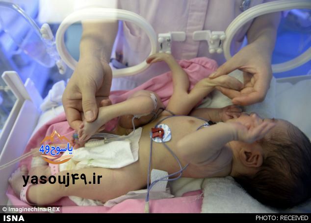 فاجعه در اتاق عمل؛ تیغ جراح روی گلوی نوزادی که مشکل چشم داشت!